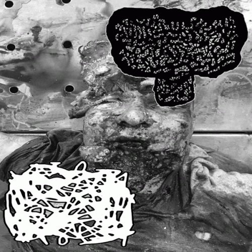 Carcinoma Basocelular : Stromal Myoma - Carcinoma Basocelular Carcinoma Basocelular : Stromal Myoma - Carcinoma Basocelular